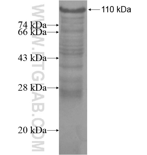 PSD4 fusion protein Ag14667 SDS-PAGE PSD4 fusion protein Ag14667 SDS-PAGE