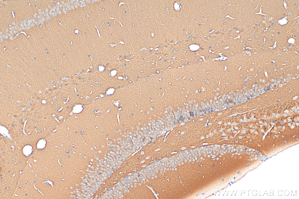 Immunohistochemistry (IHC) staining of mouse brain tissue using PSD95 Polyclonal antibody (30255-1-AP)