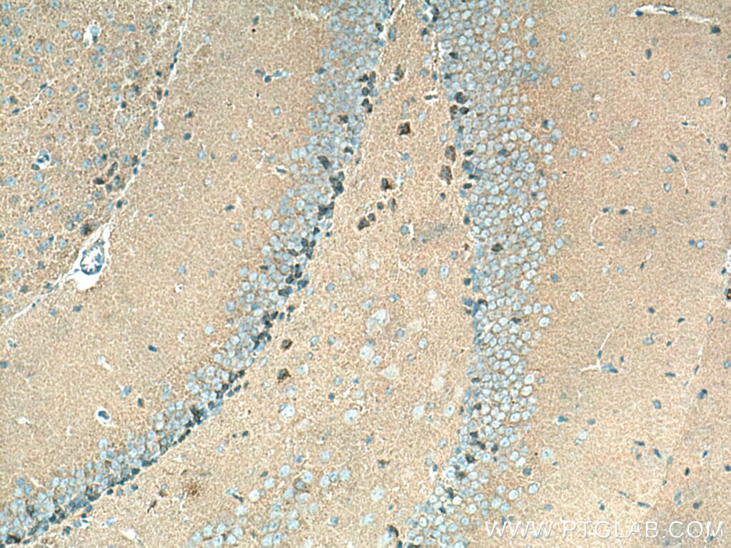 Immunohistochemistry (IHC) staining of mouse brain tissue using PSD95-Specific,DLG4 Polyclonal antibody (20665-1-AP)