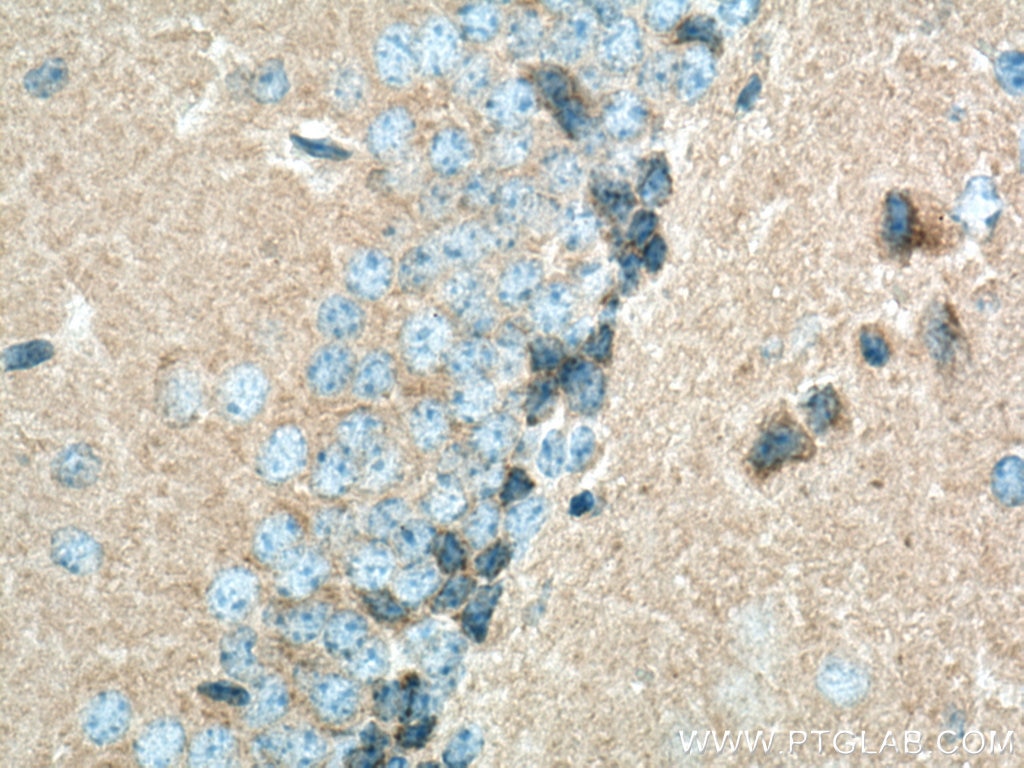 Immunohistochemistry (IHC) staining of mouse brain tissue using PSD95-Specific,DLG4 Polyclonal antibody (20665-1-AP)