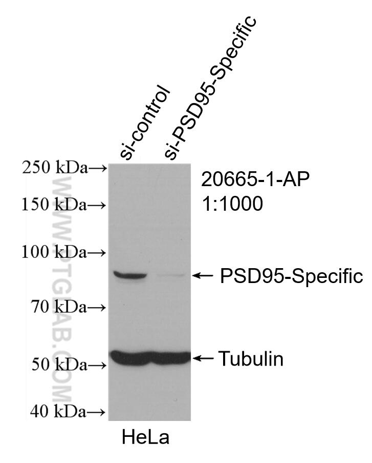 Western Blot (WB) analysis of HeLa cells using PSD95-Specific,DLG4 Polyclonal antibody (20665-1-AP)