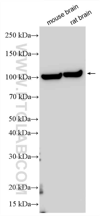 Western Blot (WB) analysis of various lysates using PSD95-Specific Polyclonal antibody (20665-1-AP)