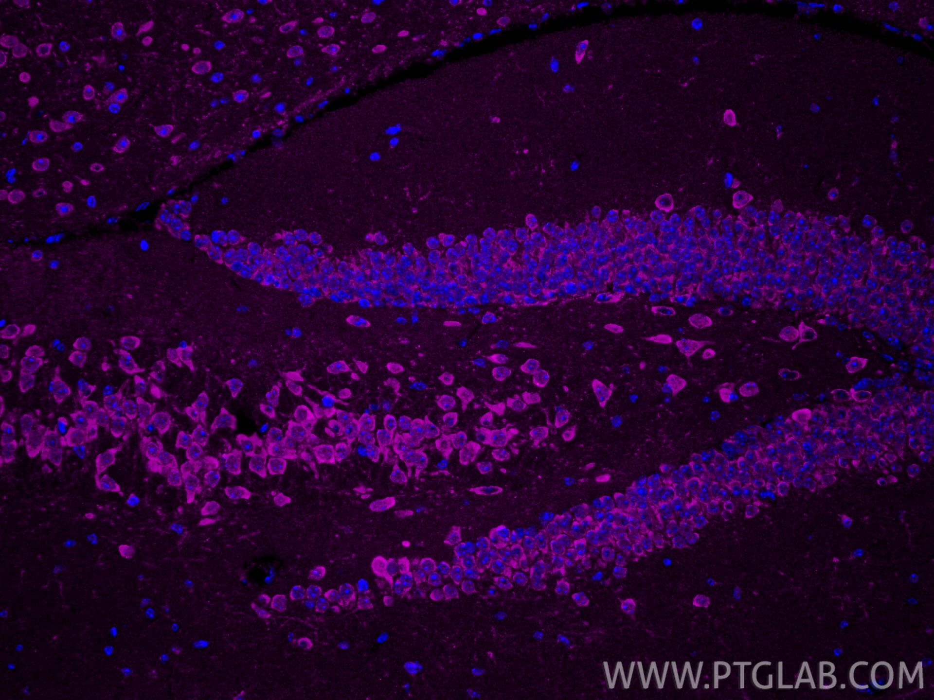 IF Staining of mouse brain using CL647-81106 Immunofluorescence (IF) / fluorescent staining of mouse brain tissue using CoraLite® Plus 647-conjugated PSD95-Specific Recom (CL647-81106)