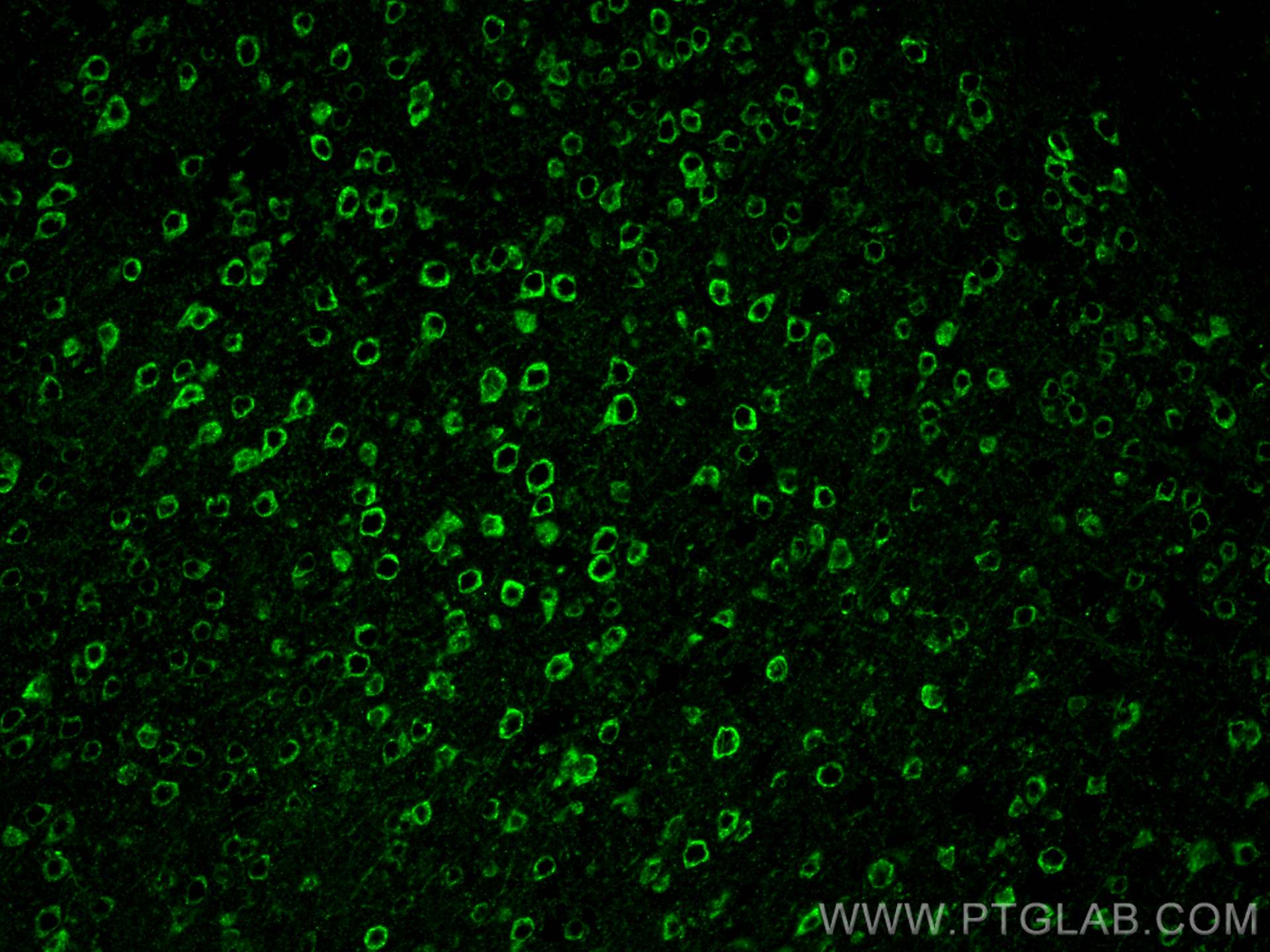 Immunofluorescence (IF) / fluorescent staining of mouse brain tissue using PSD95-Specific,DLG4 Recombinant antibody (81106-1-RR)