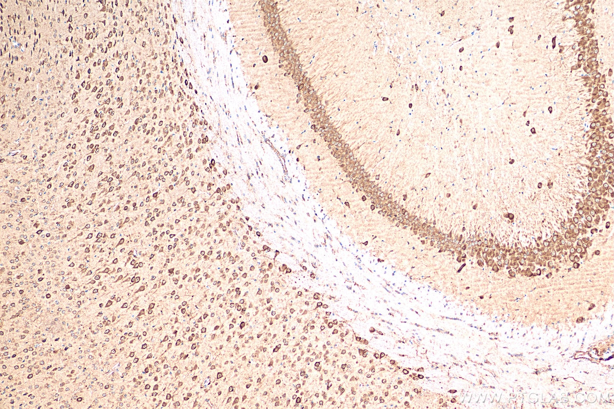 Immunohistochemistry (IHC) staining of mouse brain tissue using PSD95-Specific,DLG4 Recombinant antibody (81106-1-RR)