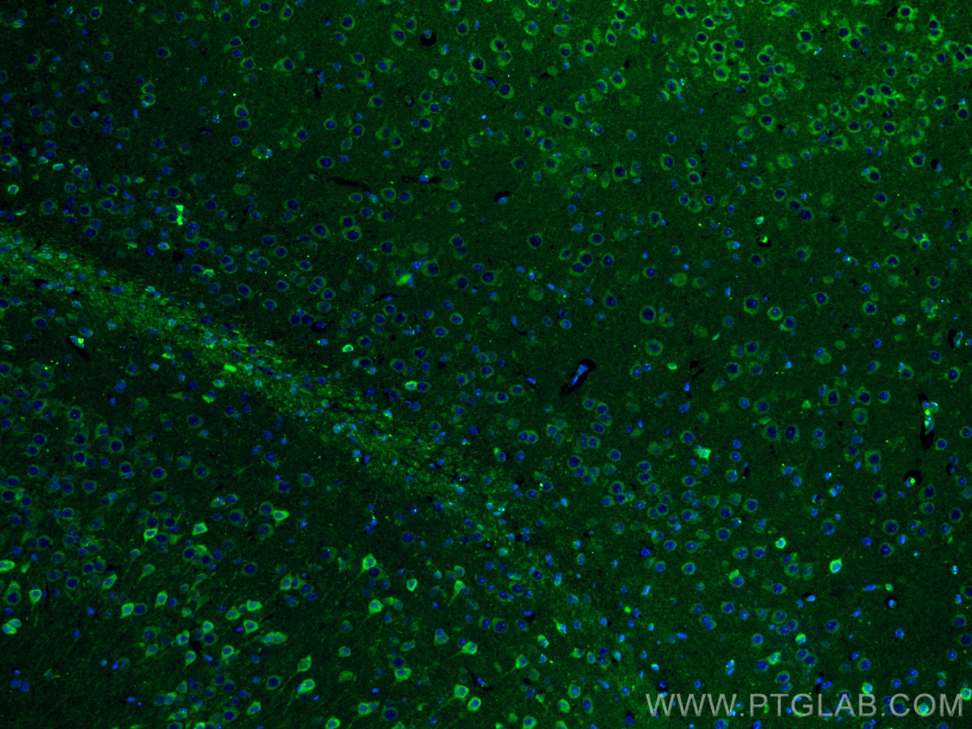 Immunofluorescence (IF) / fluorescent staining of mouse brain tissue using PSEN1 Polyclonal antibody (20434-1-AP)