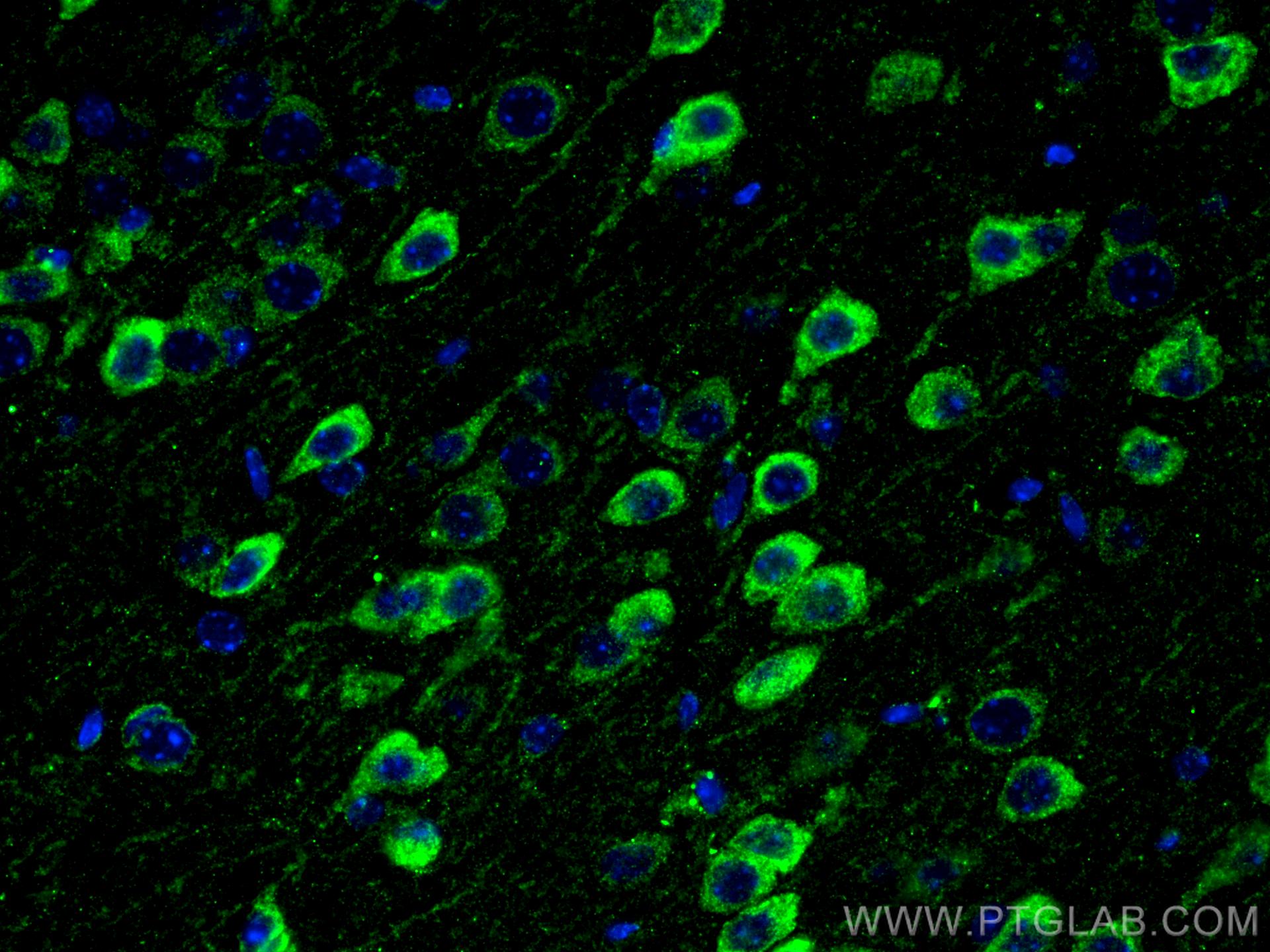 Immunofluorescence (IF) / fluorescent staining of mouse brain tissue using PSEN1 Polyclonal antibody (20434-1-AP)