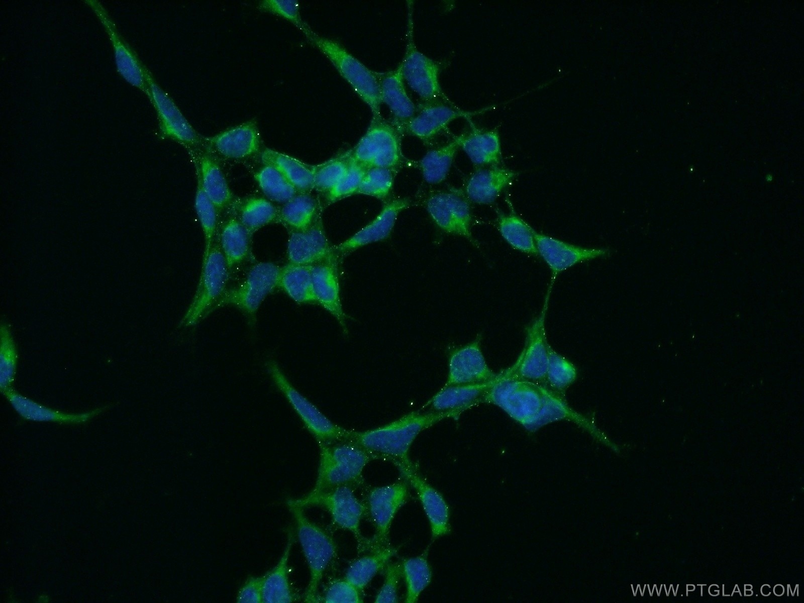 Immunofluorescence (IF) / fluorescent staining of HEK-293 cells using PSEN1 Polyclonal antibody (20434-1-AP)