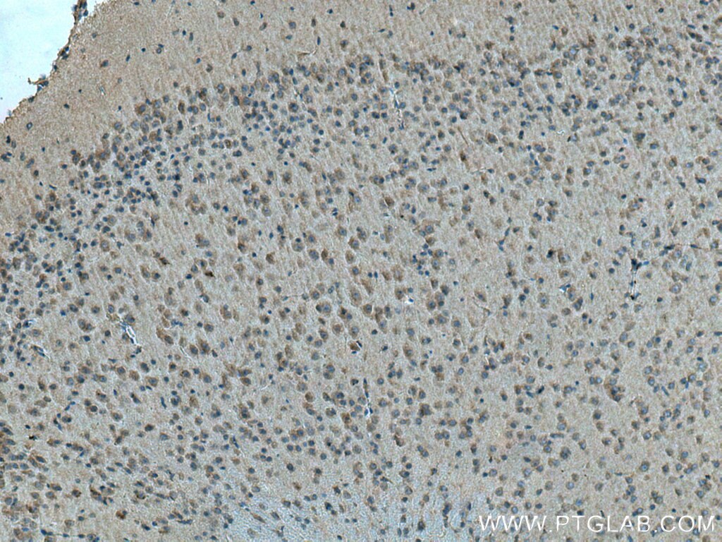 Immunohistochemistry (IHC) staining of mouse brain tissue using PSEN1 Polyclonal antibody (20434-1-AP)