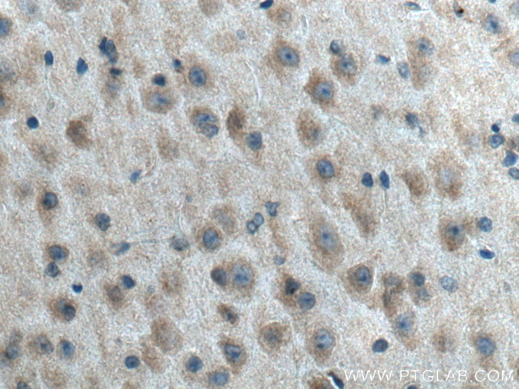 Immunohistochemistry (IHC) staining of mouse brain tissue using PSEN1 Polyclonal antibody (20434-1-AP)