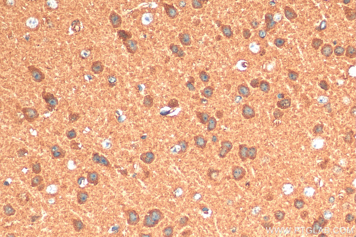 Immunohistochemistry (IHC) staining of mouse brain tissue using Presenilin-1-Specific Polyclonal antibody (16163-1-AP)