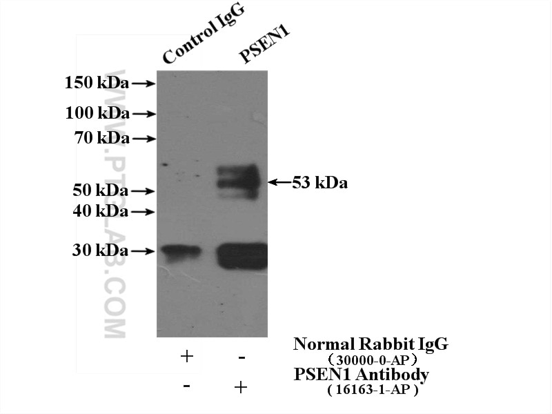 IP experiment of mouse kidney using 16163-1-AP