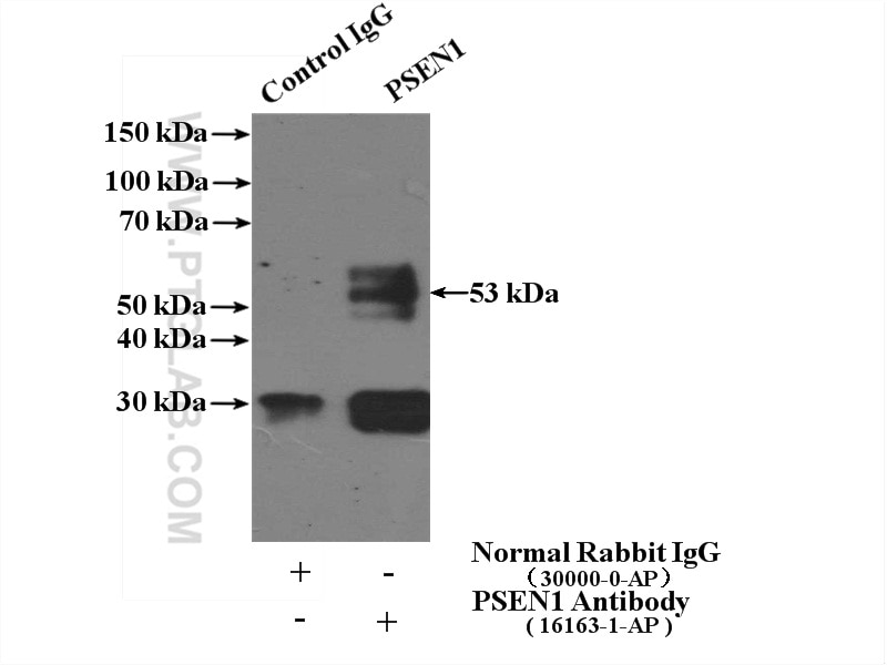 Immunoprecipitation (IP) experiment of mouse kidney tissue using Presenilin-1-Specific Polyclonal antibody (16163-1-AP)