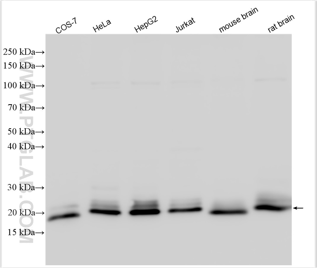 Western Blot (WB) analysis of various lysates using Presenilin-1-Specific Polyclonal antibody (16163-1-AP)