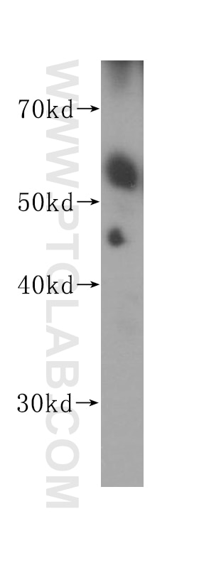 Presenilin-1-Specific Polyclonal antibody