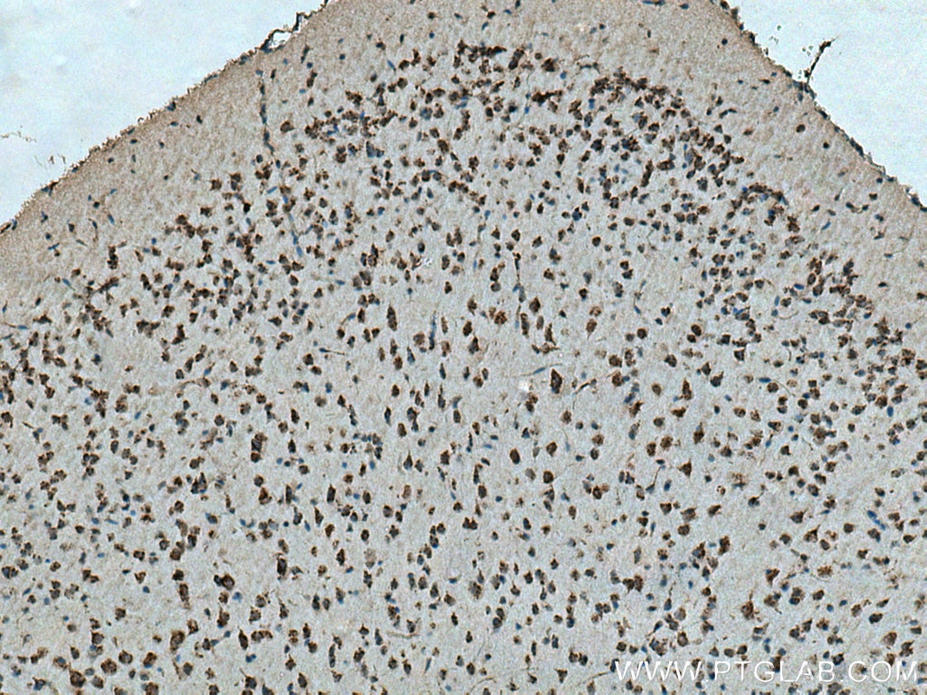 Immunohistochemistry (IHC) staining of mouse brain tissue using PSEN2-Specific Polyclonal antibody (16168-1-AP)