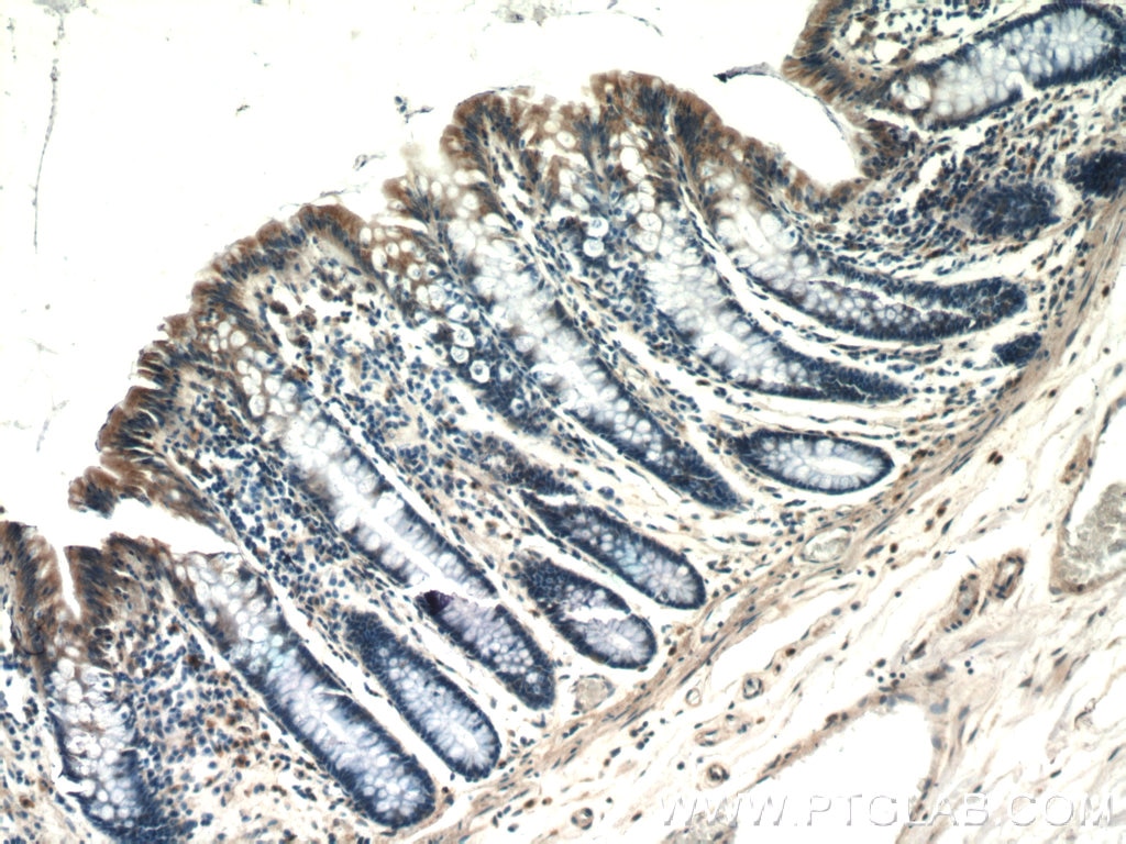 IHC staining of human colon using 16168-1-AP