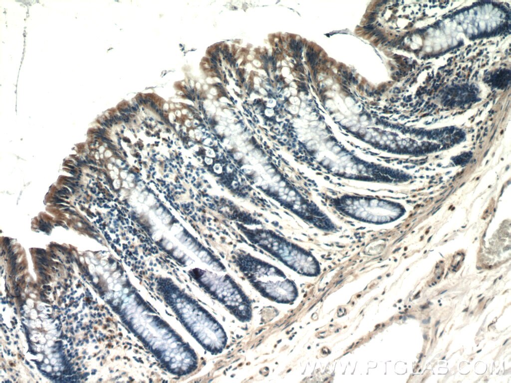 Immunohistochemistry (IHC) staining of human colon tissue using PSEN2-Specific Polyclonal antibody (16168-1-AP)