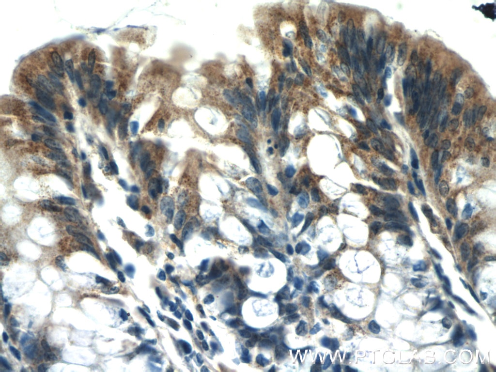 Immunohistochemistry (IHC) staining of human colon tissue using PSEN2-Specific Polyclonal antibody (16168-1-AP)