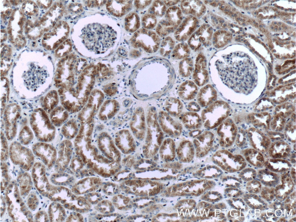 Immunohistochemistry (IHC) staining of human kidney tissue using PSEN2-Specific Polyclonal antibody (16168-1-AP)