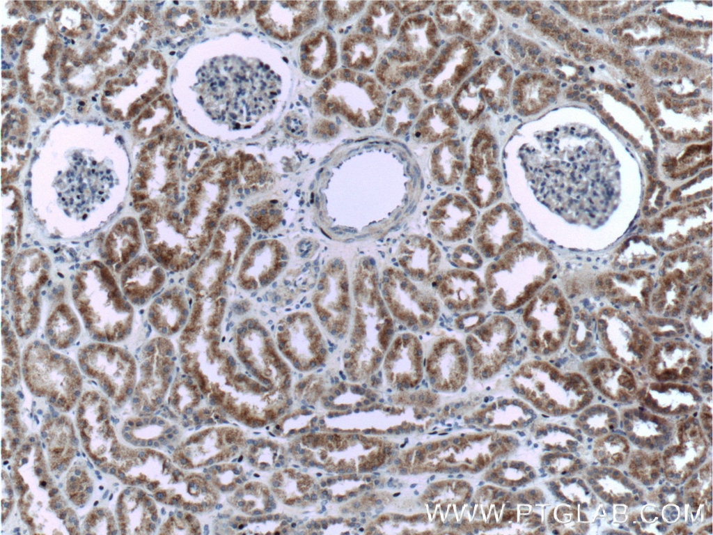 IHC staining of human kidney using 16168-1-AP