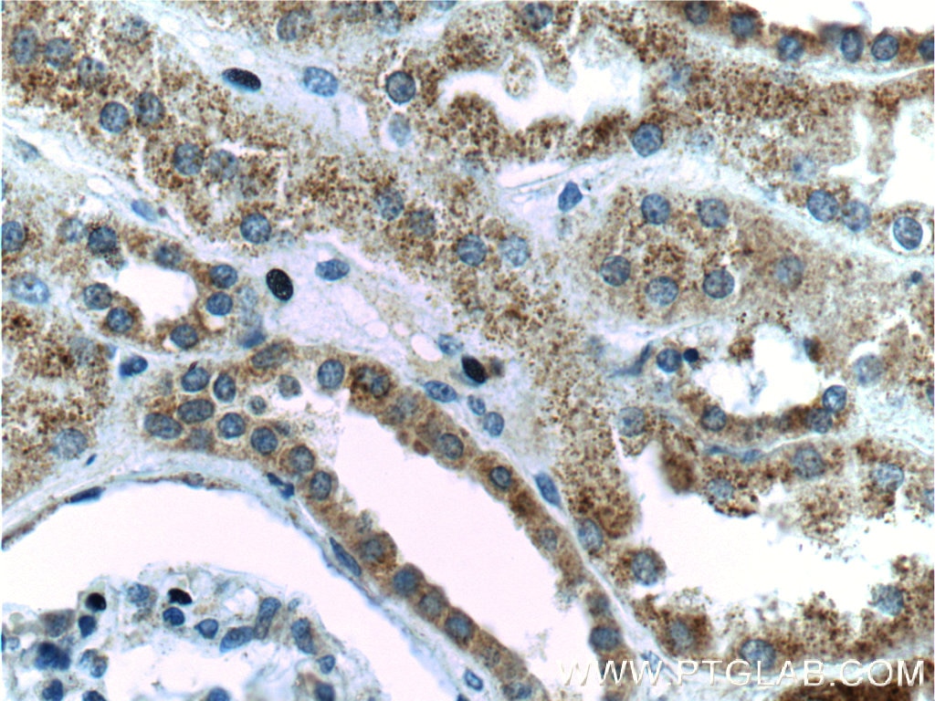 Immunohistochemistry (IHC) staining of human kidney tissue using PSEN2-Specific Polyclonal antibody (16168-1-AP)