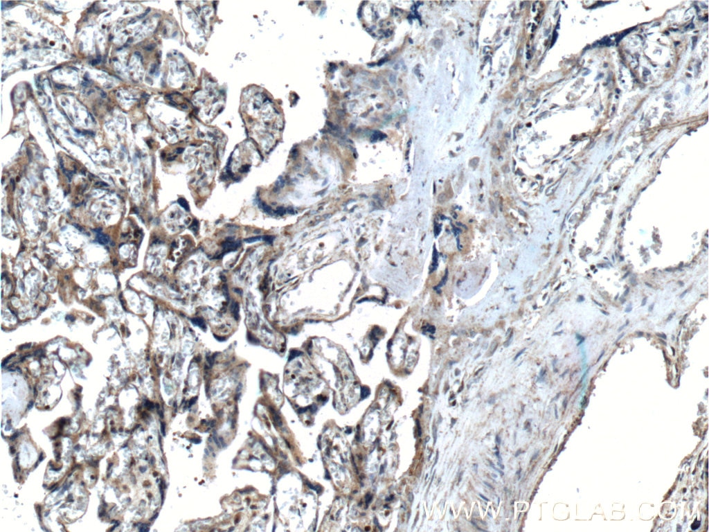 Immunohistochemistry (IHC) staining of human placenta tissue using PSEN2-Specific Polyclonal antibody (16168-1-AP)