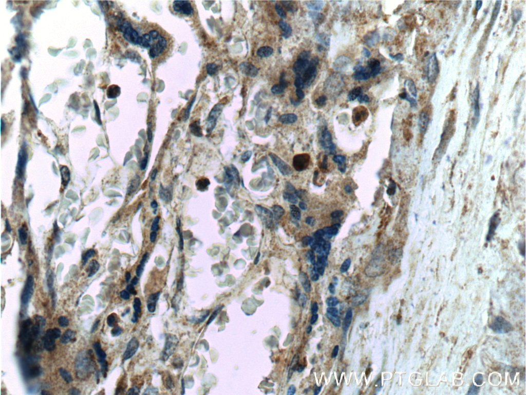 Immunohistochemistry (IHC) staining of human placenta tissue using PSEN2-Specific Polyclonal antibody (16168-1-AP)