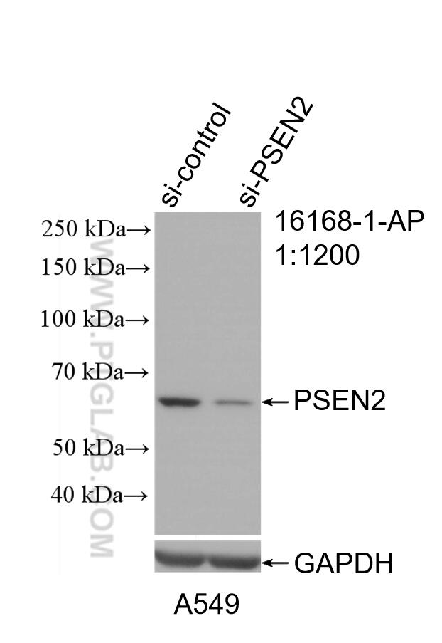 Western Blot (WB) analysis of A549 cells using PSEN2-Specific Polyclonal antibody (16168-1-AP)