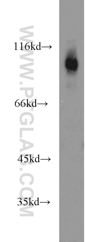 PSEN2-Specific