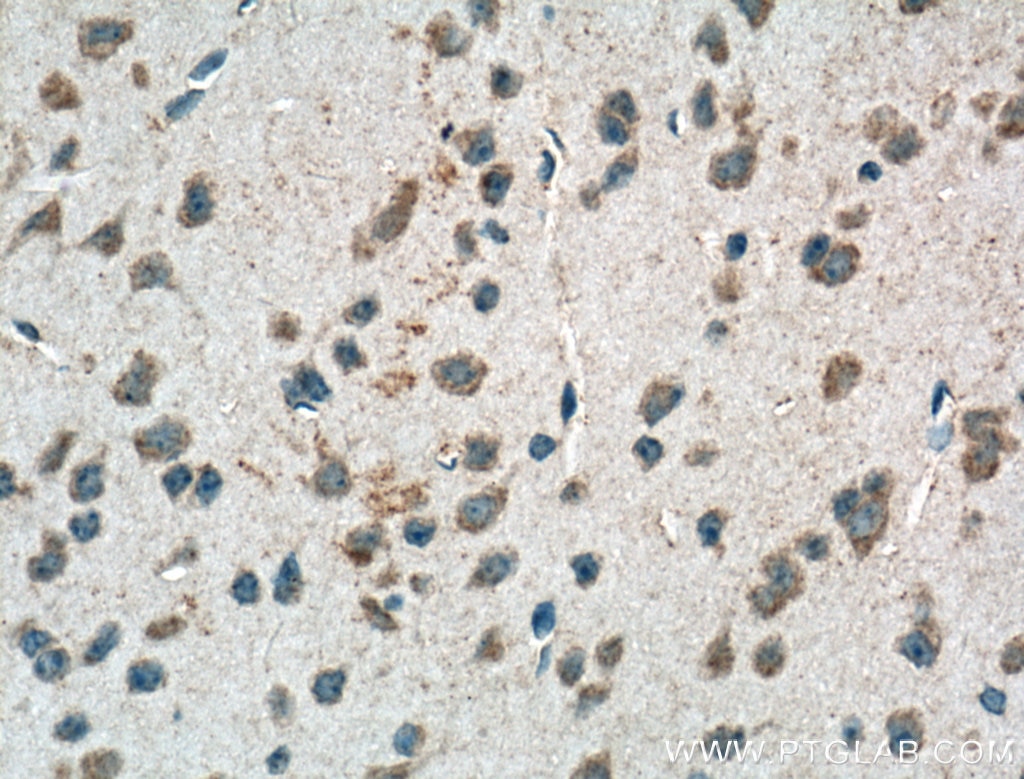 Immunohistochemistry (IHC) staining of mouse brain tissue using PSENEN Polyclonal antibody (16144-1-AP)