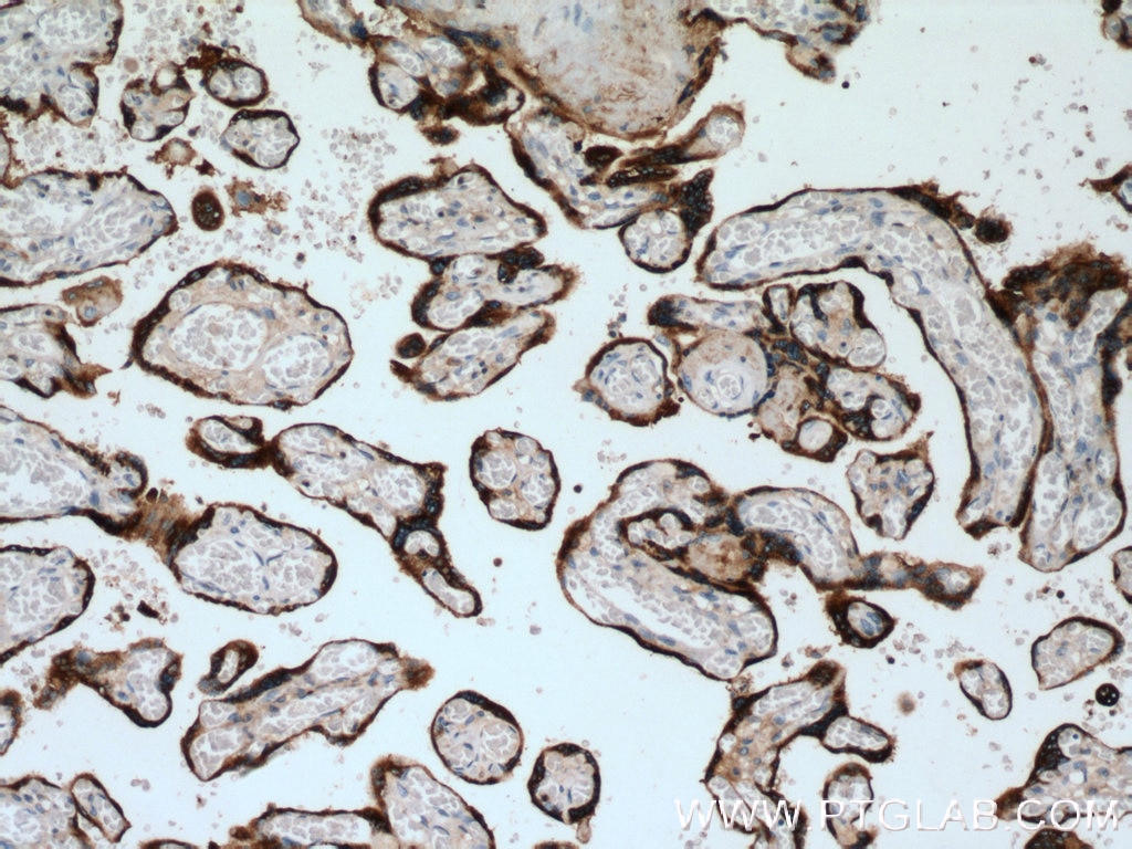 IHC staining of human placenta using 11809-1-AP