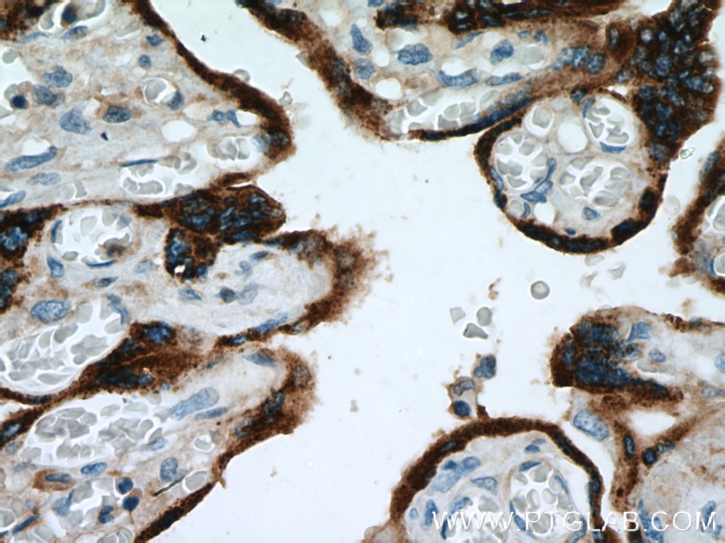 Immunohistochemistry (IHC) staining of human placenta tissue using PSG1 Polyclonal antibody (11809-1-AP)