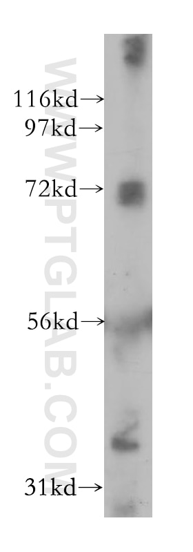 Western Blot (WB) analysis of MCF-7 cells using PSG1 Polyclonal antibody (11809-1-AP)