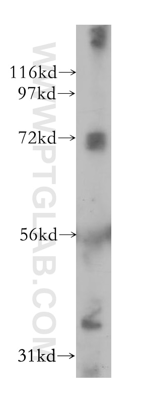 WB analysis of MCF-7 using 11809-1-AP