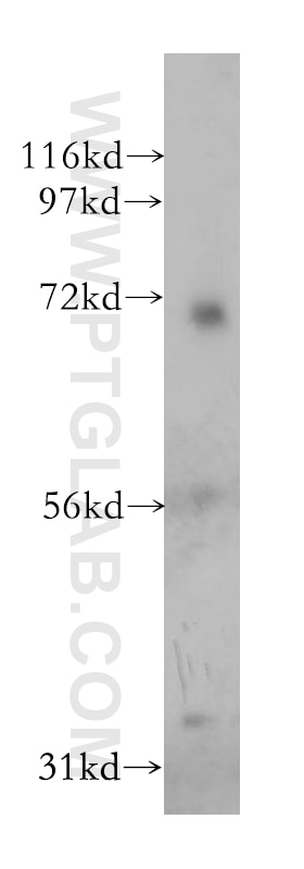 Western Blot (WB) analysis of human kidney tissue using PSG1 Polyclonal antibody (11809-1-AP)