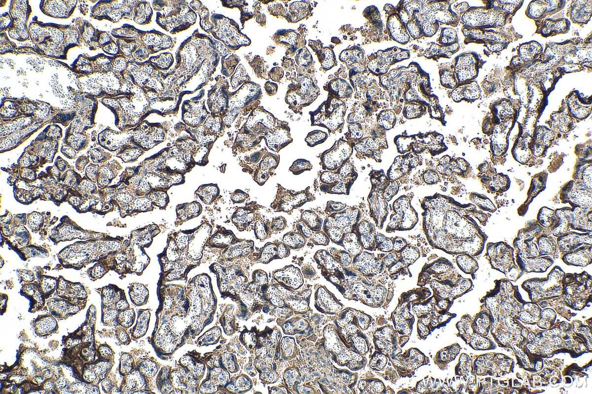 Immunohistochemistry (IHC) staining of human placenta tissue using PSG1 Monoclonal antibody (67269-1-Ig)
