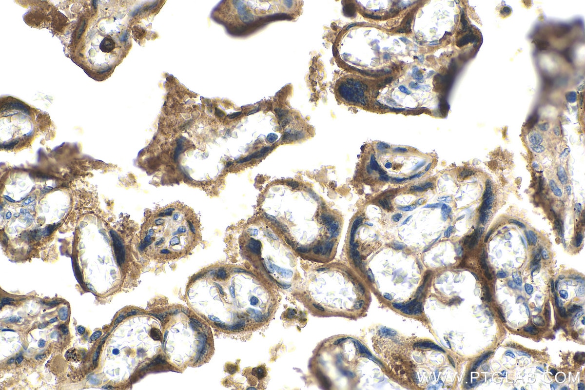 IHC staining of human placenta using 67269-1-Ig