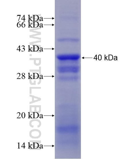 PSG1 fusion protein Ag28604 SDS-PAGE