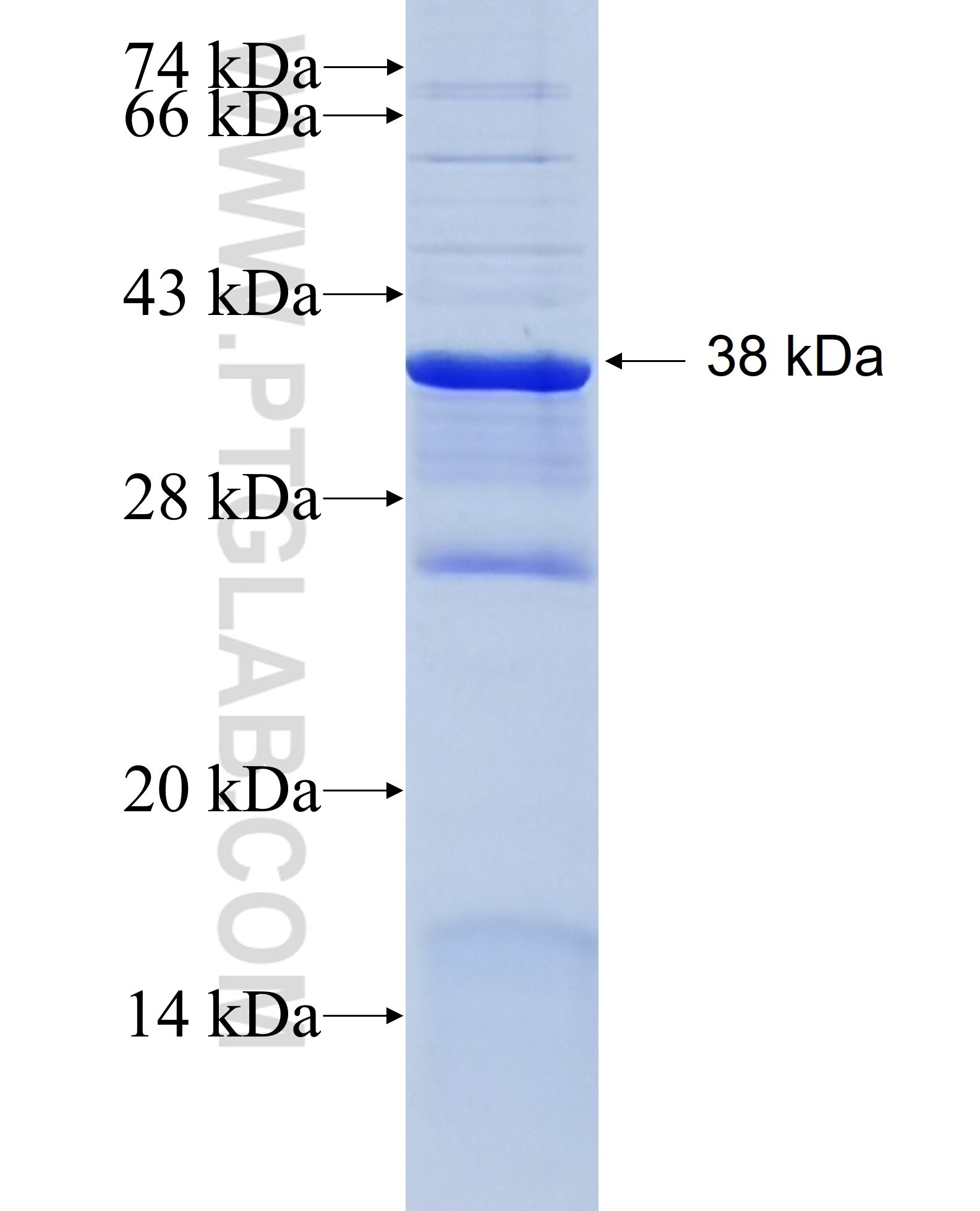 PSG1 fusion protein Ag28604 SDS-PAGE