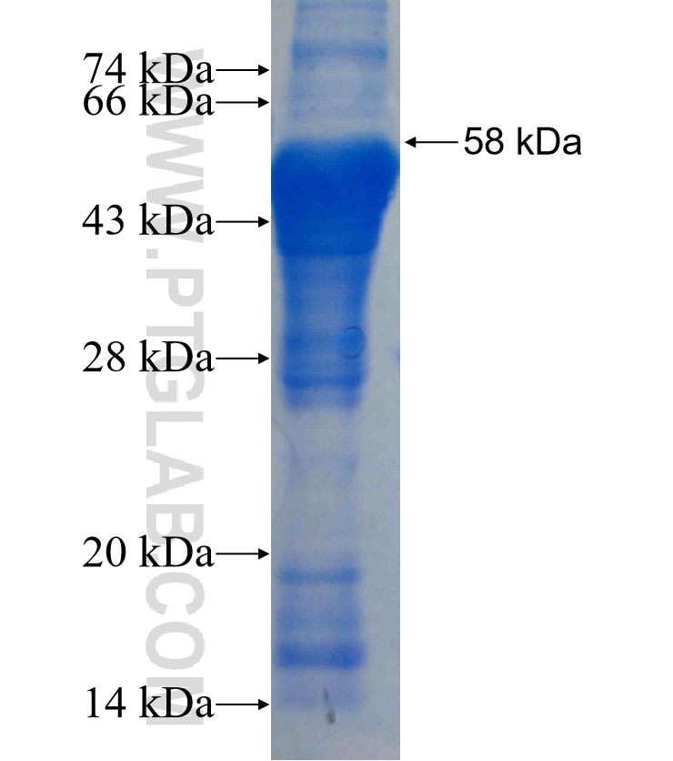 PSG1 fusion protein Ag2468 SDS-PAGE