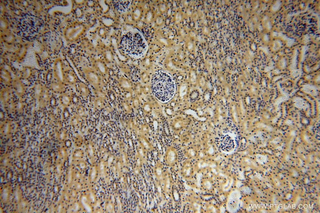 Immunohistochemistry (IHC) staining of human kidney tissue using PSG11 Polyclonal antibody (16352-1-AP)
