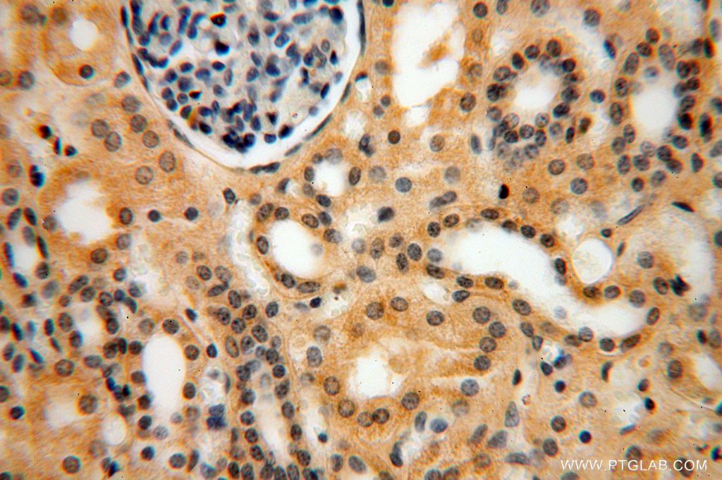 Immunohistochemistry (IHC) staining of human kidney tissue using PSG11 Polyclonal antibody (16352-1-AP)