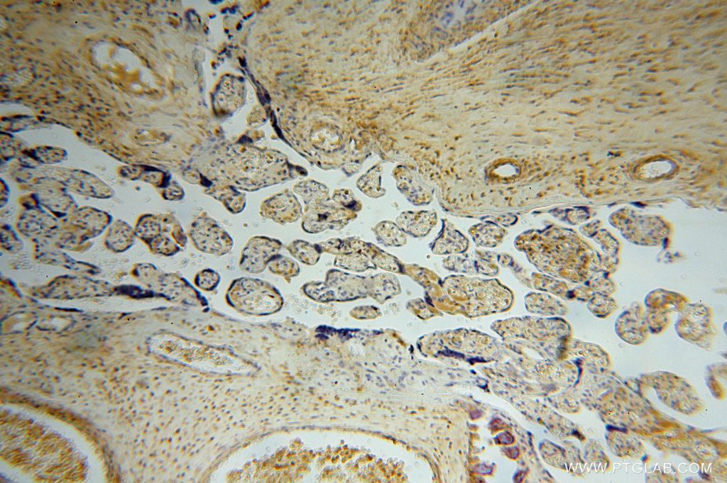 Immunohistochemistry (IHC) staining of human placenta tissue using PSG11 Polyclonal antibody (16352-1-AP)