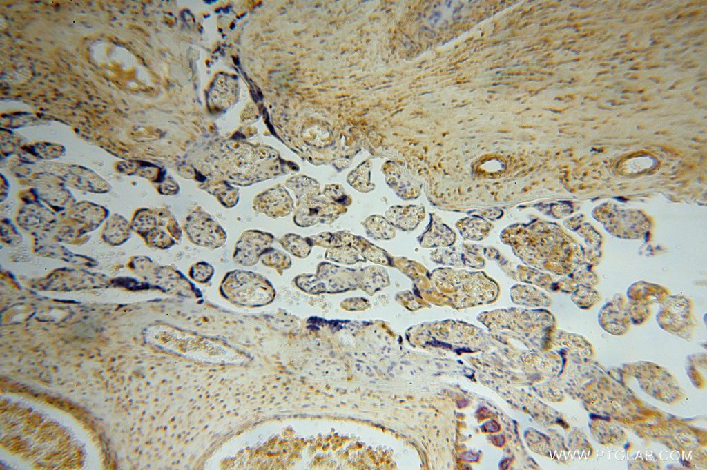 IHC staining of human placenta using 16352-1-AP