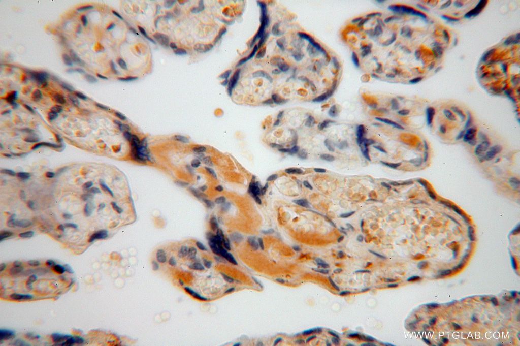 Immunohistochemistry (IHC) staining of human placenta tissue using PSG11 Polyclonal antibody (16352-1-AP)