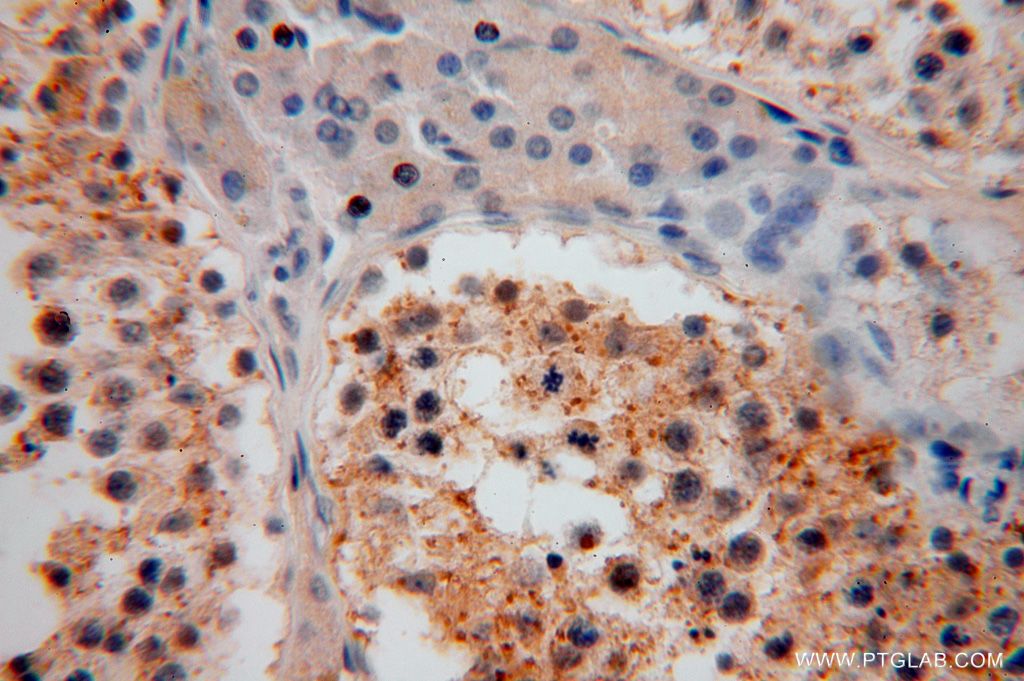 Immunohistochemistry (IHC) staining of human testis tissue using PSG11 Polyclonal antibody (16352-1-AP)