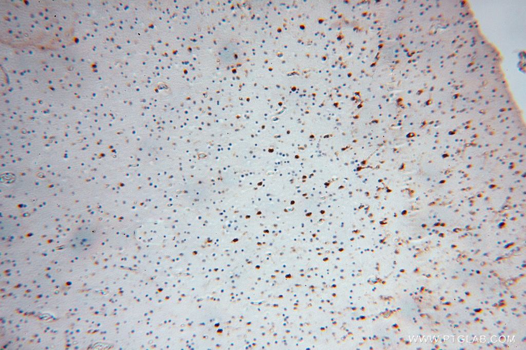 Immunohistochemistry (IHC) staining of human brain tissue using PSG11 Polyclonal antibody (16352-1-AP)