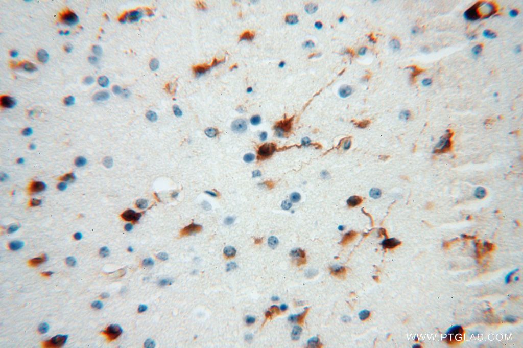 Immunohistochemistry (IHC) staining of human brain tissue using PSG11 Polyclonal antibody (16352-1-AP)