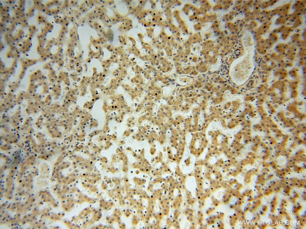 IHC staining of human liver using 16352-1-AP